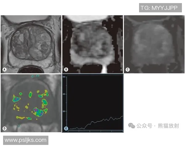 约维奇伤情更新：X光阴性，明日MRI